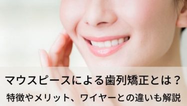 マウスピースを使った歯列矯正とは？メリットやワイヤー矯正との違い